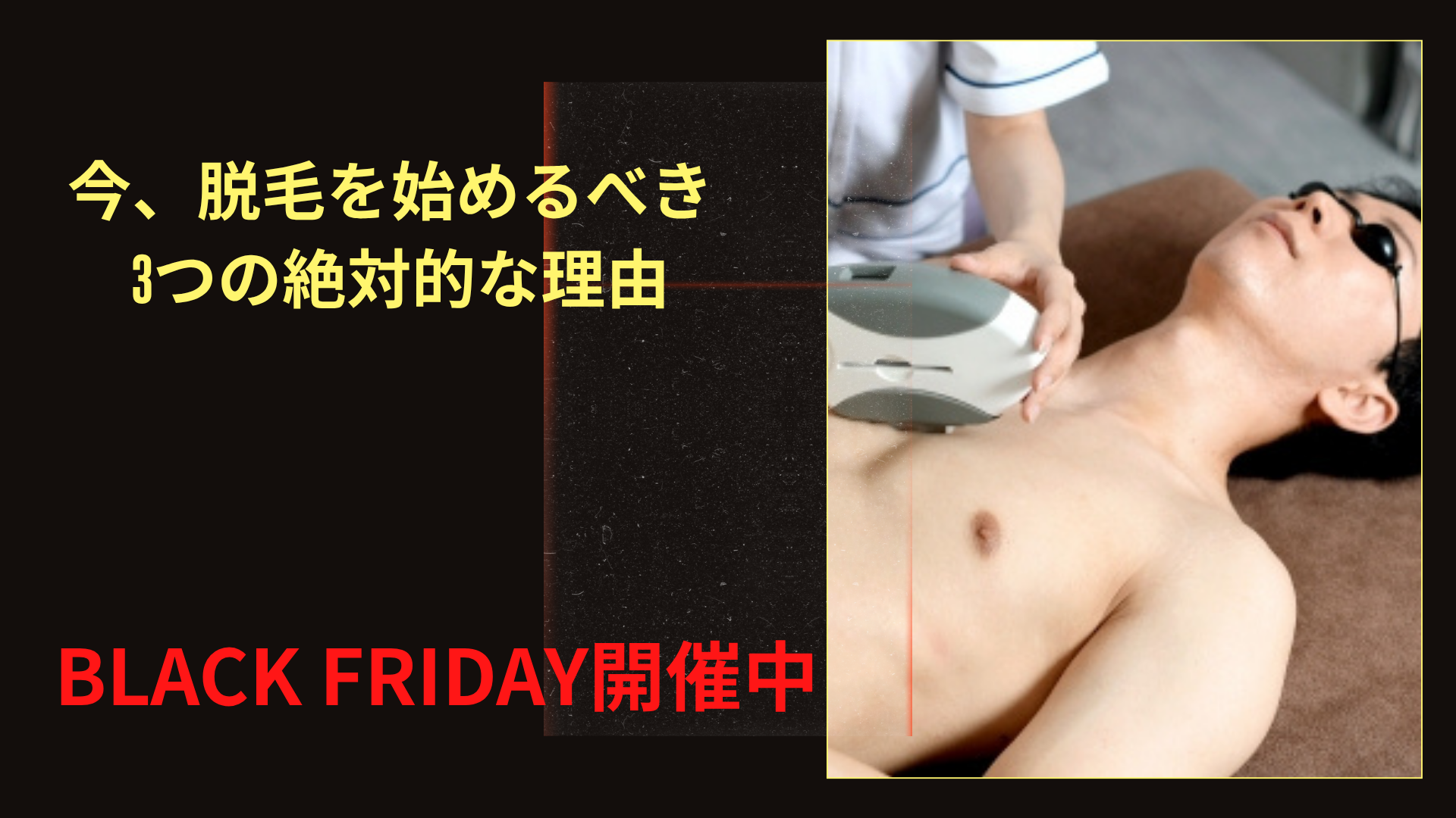 今、脱毛を始めるべき3つの絶対的な理由