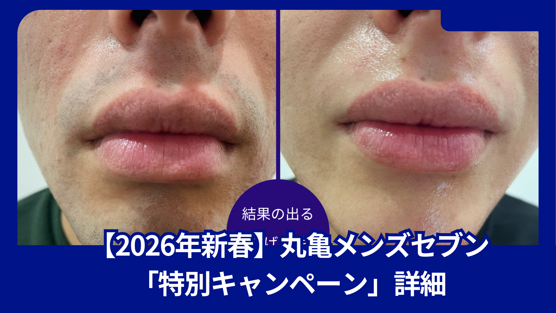 【2026年新春】丸亀メンズセブン「特別キャンペーン」詳細