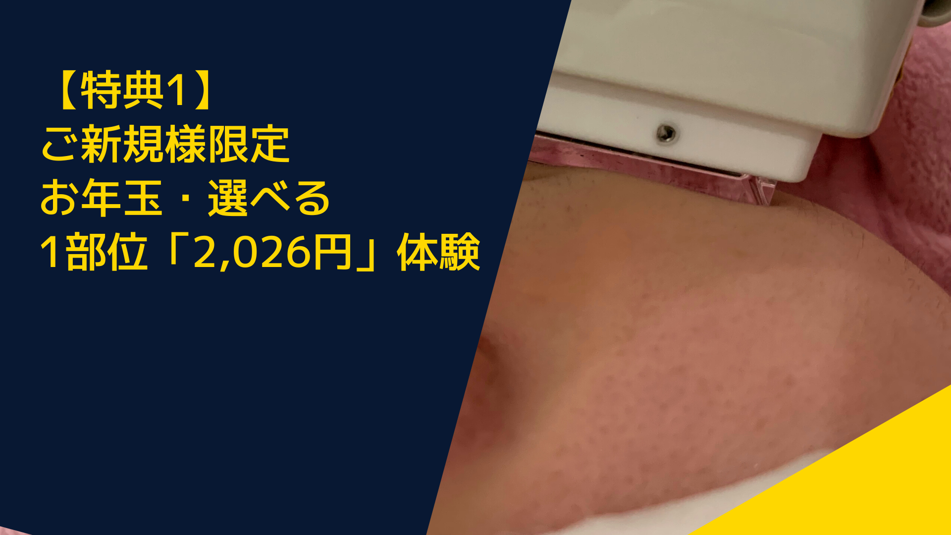 【特典1】ご新規様限定:お年玉・選べる1部位「2,026円」体験