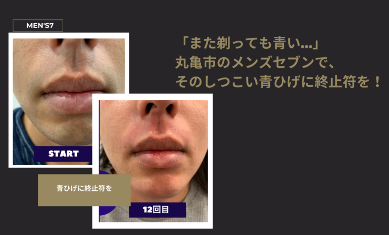 青ひげに終止符を